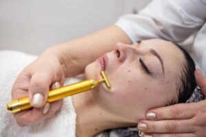 microneedling for acne scar treatment Vacaville ca